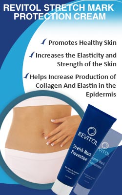 revitol stretch mark prevention cream