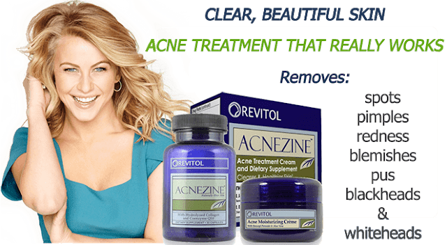 best natural acne treatment
